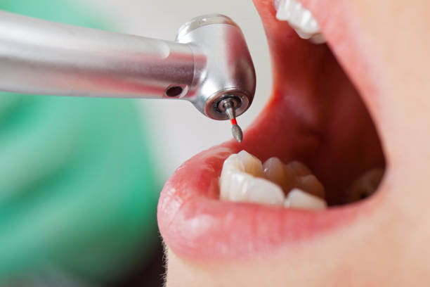 Best Emergency Treatment for Oral Infections in Brighton, TN